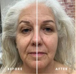 Virello™ Lymphatic Face Brush